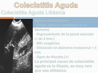 Colecistitis Crónica