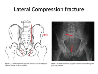 Radiological evaluation of Lower Limb in acute ED setting !! | PPTX
