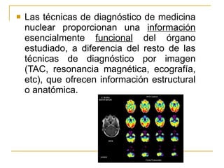 Las técnicas de diagnóstico de medicina nuclear proporcionan una  información  esencialmente  funcional  del órgano estudiado, a diferencia del resto de las técnicas de diagnóstico por imagen (TAC, resonancia magnética, ecografía, etc), que ofrecen información estructural o anatómica.  