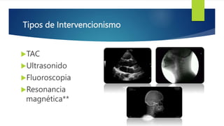 Tipos de Intervencionismo
TAC
Ultrasonido
Fluoroscopia
Resonancia
magnética**
 