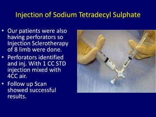 Radiofrequency ablation of varicose veins Dr. Muhammad Bin Zulfiqar | PPTX