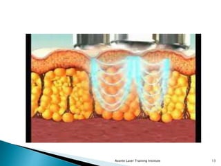 Avante Laser Training Institute 13
 