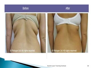 Avante Laser Training Institute 39
 