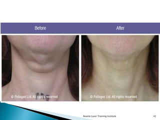 Avante Laser Training Institute 42
 