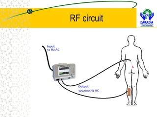 Radio Frequency Techniques in Pain Management | RFA, Pulsed RF, Cooled ...
