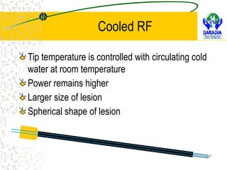 Radio Frequency Techniques in Pain Management | RFA, Pulsed RF, Cooled ...