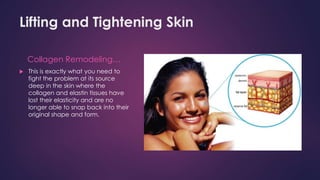 Lifting and Tightening Skin
Collagen Remodeling…
 This is exactly what you need to
fight the problem at its source
deep in the skin where the
collagen and elastin tissues have
lost their elasticity and are no
longer able to snap back into their
original shape and form.
 