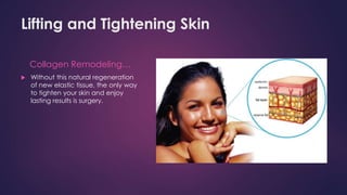 Lifting and Tightening Skin
Collagen Remodeling…
 Without this natural regeneration
of new elastic tissue, the only way
to tighten your skin and enjoy
lasting results is surgery.
 