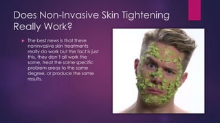 Does Non-Invasive Skin Tightening
Really Work?
 The best news is that these
noninvasive skin treatments
really do work but the fact is just
this, they don’t all work the
same, treat the same specific
problem areas to the same
degree, or produce the same
results.
 
