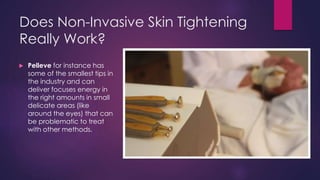 Does Non-Invasive Skin Tightening
Really Work?
 Pelleve for instance has
some of the smallest tips in
the industry and can
deliver focuses energy in
the right amounts in small
delicate areas (like
around the eyes) that can
be problematic to treat
with other methods.
 