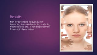 Results…
Non-invasive radio frequency skin
tightening, laser skin tightening, surfacing,
fractional co2, etc., is not a replacement
for a surgical procedure.
 