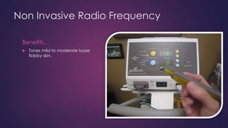 Non Invasive Radio Frequency
Benefits…
 Tones mild to moderate loose
flabby skin.
 