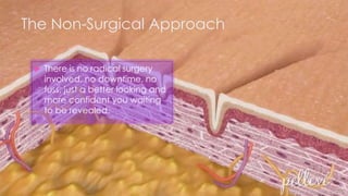 The Non-Surgical Approach
 There is no radical surgery
involved, no downtime, no
fuss, just a better looking and
more confident you waiting
to be revealed.
 