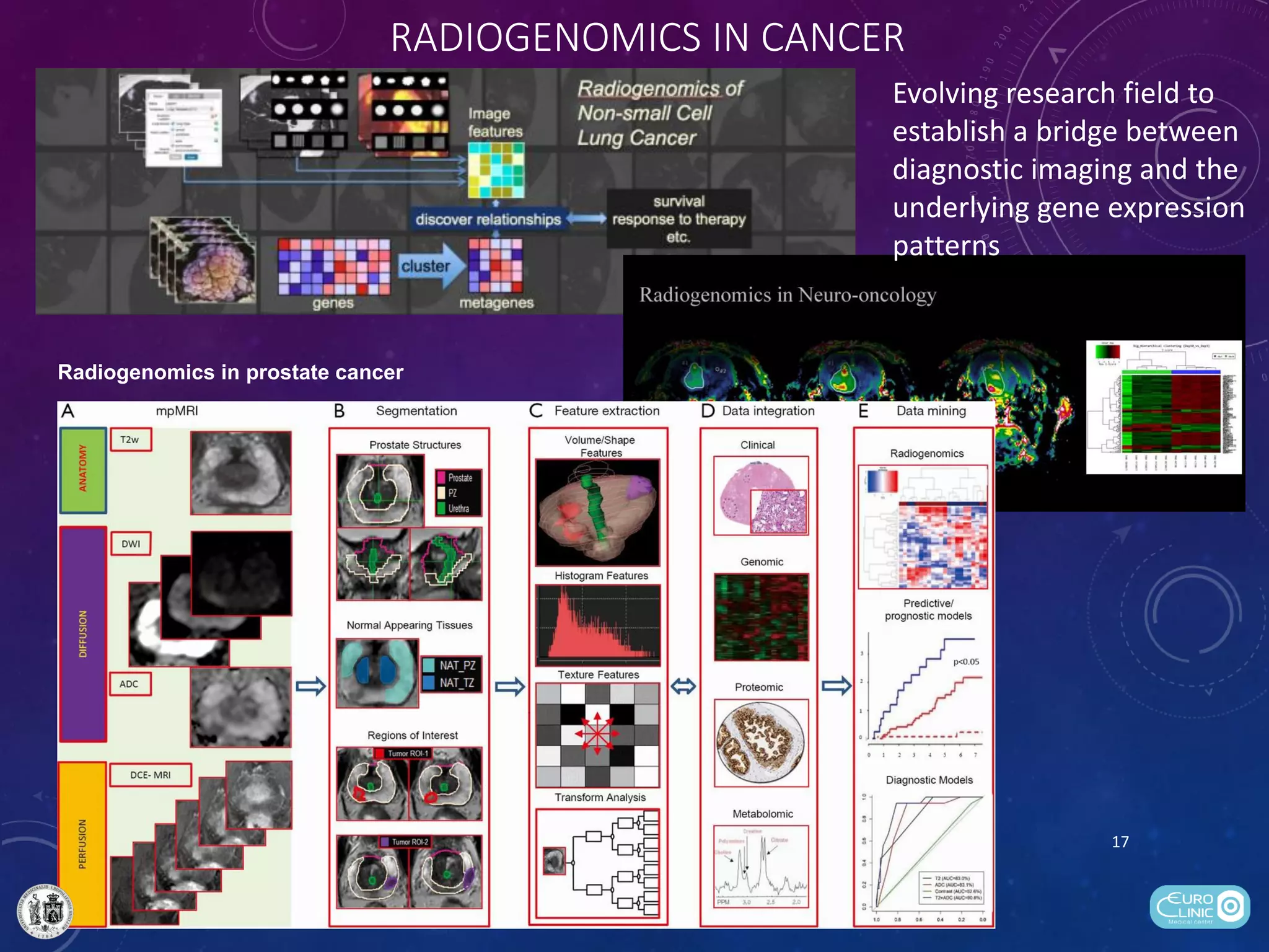 Radiogenomics of renal cell carcinoma | PDF