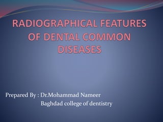 Prepared By : Dr.Mohammad Nameer
Baghdad college of dentistry
 