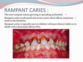 RAMPANT CARIES :
The term rampant means growing or spreading unchecked.
Rampant caries is advanced and severe caries which affects numerous
teeth in the dentition.
Rampant caries is typically seen in children with poor dietary habits or in
adults with a decreased salivary flow
 