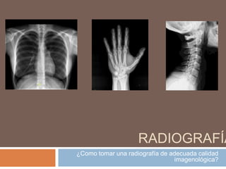 RADIOGRAFÍA
¿Como tomar una radiografía de adecuada calidad
imagenológica?
 