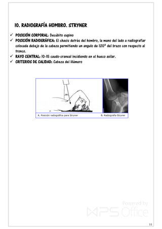 11
10. RADIOGRAFÍA HOMBRO. STRYNER
 POSICIÓN CORPORAL: Decúbito supino
 POSICIÓN RADIOGRÁFICA: El chasis detrás del hombro, la mano del lado a radiografiar
colocada debajo de la cabeza permitiendo un angulo de 120º del brazo con respecto al
tronco.
 RAYO CENTRAL: 10-15 caudo-craneal incidiendo en el hueco axilar.
 CRITERIOS DE CALIDAD: Cabeza del Húmero
A. Posición radiográfica para Stryner B. Radiografía Stryner
 