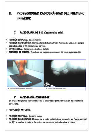 12
II. PROYECCIONES RADIOGRÁFICAS DEL MIEMBRO
INFERIOR
7. RADIOGRAFÍA DE PIE. Sesamoideo axial.
 POSICIÓN CORPORAL: Bipedestación.
 POSICIÓN RADIOGRÁFICA: Pierna extendida hacia atrás y flexionada. Los dedos del pie
apoyados sobre el RI. (posición de carrera)
 RAYO CENTRAL: Tangencial a la planta del pie
 CRITERIOS DE CALIDAD: Visualizar los huesos sesamoideos libres de superposición.
8. RADIOGRAFÍA SCHENEIDER
En etapas tempranas o intermedias de la coxartrosis para planificación de osteotomía
correctora.
 PROYECCIÓN ANTERIOR:
 POSICIÓN CORPORAL: Decúbito supino
 POSICIÓN RADIOGRÁFICA: El muslo de la cadera afectada se encuentra en flexión vertical
de 45º a nivel de la cadera. La cadera se encuentra aplicada sobre el chasis
A. Posición radiográfica del Sesamoide. B. Radiografía Sesamoide axial.
 