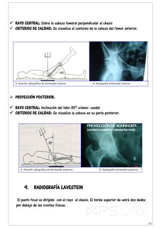 13
 RAYO CENTRAL: Sobre la cabeza femoral perpendicular al chasis
 CRITERIOS DE CALIDAD: Se visualiza el contorno de la cabeza del fémur anterior.
 PROYECCIÓN POSTERIOR:
 RAYO CENTRAL: Inclinación del tubo 30º cráneo- caudal
 CRITERIOS DE CALIDAD: Se visualiza la cabeza en su parte posterior.
9. RADIOGRAFÍA LAVESTEIN
El punto focal va dirigido con el rayo al chasis. El borde superior de unirá dos dedos
por debajo de las crestas ilíacas.
A. Posición radiográfica de Scheneider anterior B. Radiografía Scheneider anterior
A. Posición radiográfica de Scheneider posterior B. Radiografía Scheneider posterior
 