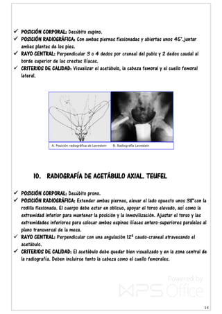 14
 POSICIÓN CORPORAL: Decúbito supino.
 POSICIÓN RADIOGRÁFICA: Con ambas piernas flexionadas y abiertas unos 45°.juntar
ambas plantas de los pies.
 RAYO CENTRAL: Perpendicular 3 o 4 dedos por craneal del pubis y 2 dedos caudal al
borde superior de las crestas ilíacas.
 CRITERIOS DE CALIDAD: Visualizar el acetábulo, la cabeza femoral y el cuello femoral
lateral.
10. RADIOGRAFÍA DE ACETÁBULO AXIAL. TEUFEL
 POSICIÓN CORPORAL: Decúbito prono.
 POSICIÓN RADIOGRÁFICA: Extender ambas piernas, elevar el lado opuesto unos 38°con la
rodilla flexionada. El cuerpo debe estar en oblicuo, apoyar el torso elevado, así como la
extremidad inferior para mantener la posición y la inmovilización. Ajustar el torso y las
extremidades inferiores para colocar ambas espinas ilíacas antero-superiores paralelas al
plano transversal de la mesa.
 RAYO CENTRAL: Perpendicular con una angulación 12º caudo-craneal atravesando el
acetábulo.
 CRITERIOS DE CALIDAD: El acetábulo debe quedar bien visualizado y en la zona central de
la radiografía. Deben incluirse tanto la cabeza como el cuello femorales.
A. Posición radiográfica de Lavestein B. Radiografía Lavestein
 