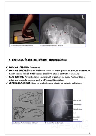 8
6. RADIOGRAFÍA DEL OLÉCRANON (flexión máxima)
 POSICIÓN CORPORAL: Sedestación.
 POSICIÓN RADIOGRÁFICA: La superficie dorsal del brazo apoyado en el RI, el antebrazo en
flexión máxima con los dedos tocando el hombro. El codo centrado en el chasis.
 RAYO CENTRAL: Perpendicular al olécranon. Si el paciente no puede flexionar bien el
antebrazo se angulará el rayo central 15º en sentido cefálico.
 CRITERIOS DE CALIDAD: Debe verse el olécranon situado por delante del húmero.
A. Posición radiográfica tangencial B. Radiografía tangencial o Marshall
A. Posición Radiográfica del olécranon B. Radiografía de olécranon
 