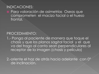 CEFALOGRAMA P-AGENERALIDADESEn los cefalogramas posteroanteriores se utilizan los formatos de película radiográfica de 8x10 y de 10x12 pulgadas.Es preferible colocar al paciente en un cefalostato con el fin de  repetir la imagen las veces que  sea necesario para obtener valorar los cambios ortodonticos o quirúrgicos.