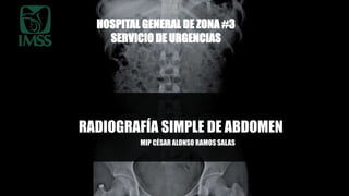 RADIOGRAFÍA SIMPLE DE ABDOMEN
MIP CÉSAR ALONSO RAMOS SALAS
HOSPITAL GENERAL DE ZONA #3
SERVICIO DE URGENCIAS
 