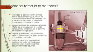 Radiografía de tórax