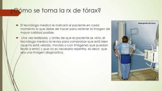 Radiografía de tórax