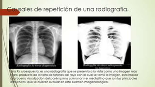 Radiografía de tórax