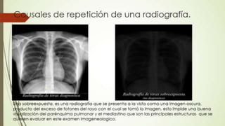 Radiografía de tórax