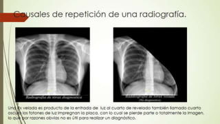 Radiografía de tórax