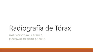 Radiografía de Tórax
MGS. VICENTE AYALA BERMEO.
ESCUELA DE MEDICINA DE CHILE.
 