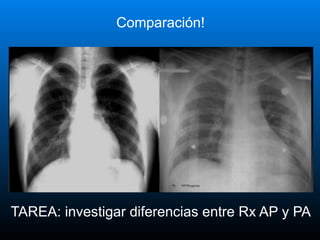 RADIOGRAFÍA NORMAL DE TÓRAX -- UNAN.pptx