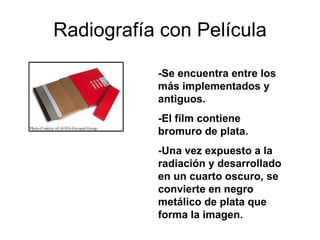 Radiografía con Película -Se encuentra entre los más implementados y antiguos. -El film contiene bromuro de plata. -Una vez expuesto a la radiación y desarrollado en un cuarto oscuro, se convierte en negro metálico de plata que forma la imagen.  