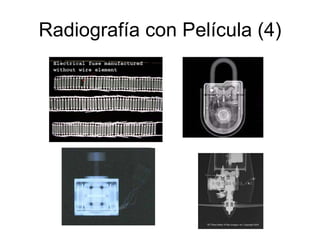 Radiografía con Película (4) 