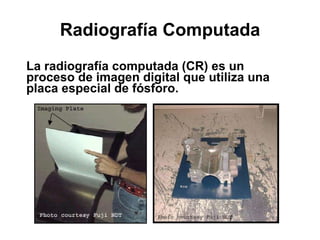 Radiografía Computada La radiografía computada (CR) es un proceso de imagen digital que utiliza una placa especial de fósforo. 