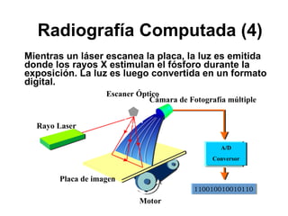 Radiografía Computada (4) Mientras un láser escanea la placa, la luz es emitida donde los rayos X estimulan el fósforo durante la exposición. La luz es luego convertida en un formato digital. Motor A/D Conversor Placa de imagen Escaner Óptico Cámara de Fotografía múltiple 110010010010110 Rayo Laser 