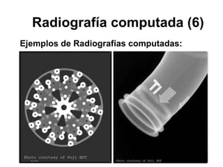 Radiografía computada (6) Ejemplos de Radiografías computadas: 