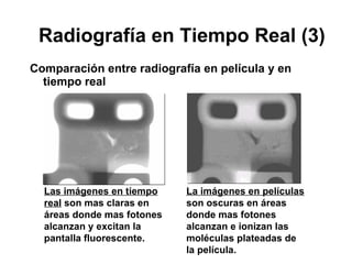 Radiografía en Tiempo Real (3) Comparación entre radiografía en película y en tiempo real Las imágenes en tiempo real  son mas claras en áreas donde mas fotones alcanzan y excitan la pantalla fluorescente. La imágenes en películas  son oscuras en áreas donde mas fotones alcanzan e ionizan las moléculas plateadas de la película. 