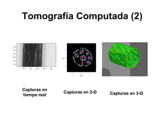 Tomografía Computada (2) Capturas en tiempo real Capturas en 2-D Capturas en 3-D 