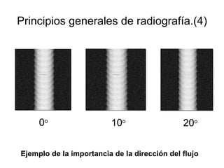 Principios generales de radiografía.(4) Ejemplo de la importancia de la dirección del flujo 0 o 10 o 20 o 