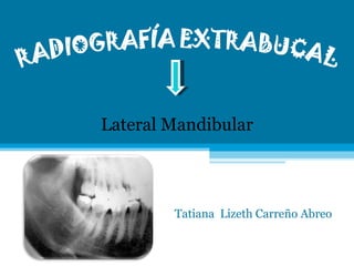 Tatiana  Lizeth Carreño Abreo Lateral Mandibular 