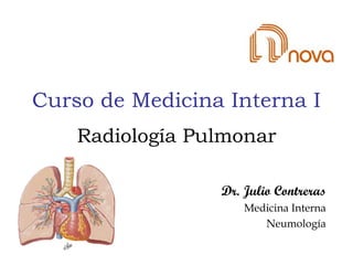 Curso de Medicina Interna I
Dr. Julio Contreras
Medicina Interna
Neumología
Radiología Pulmonar
 