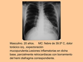 Masculino. 20 años.     MC: fiebre de 39.5º C, dolor torácico izq., expectoración mucopurulenta.Lesiones inflamatorias en dicha base, parcialmente retrocardiacas con borramiento del hemi diafragma correspondiente.  
