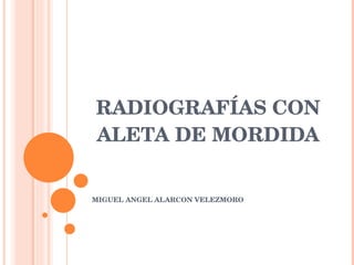 RADIOGRAFÍAS CON ALETA DE MORDIDA MIGUEL ANGEL ALARCON VELEZMORO 