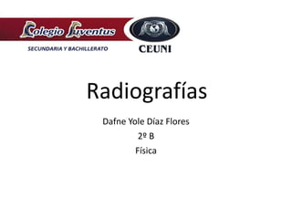 Radiografías
Dafne Yole Díaz Flores
2º B
Física
 