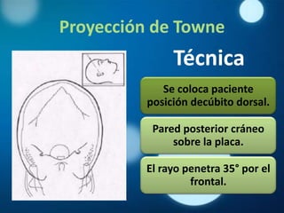 Proyección de Towne
               Técnica
             Se coloca paciente
          posición decúbito dorsal.

           Pared posterior cráneo
               sobre la placa.

          El rayo penetra 35° por el
                   frontal.
 