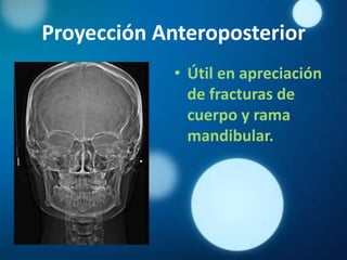 Proyección Anteroposterior
             • Útil en apreciación
               de fracturas de
               cuerpo y rama
               mandibular.
 